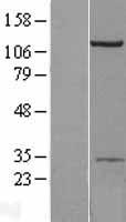 AP2B1 Human Over-expression Lysate
