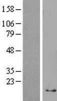 Ribosomal Protein S29 (RPS29) Human Over-expression Lysate