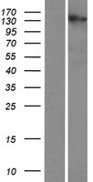 PCARE Human Over-expression Lysate
