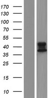 ALDH3B2 Human Over-expression Lysate