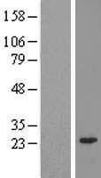 TIPRL Human Over-expression Lysate