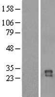 IZUMO4 Human Over-expression Lysate