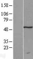 TRM11 (TRMT11) Human Over-expression Lysate