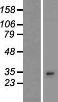 PLEKHB2 Human Over-expression Lysate