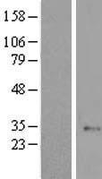 ELP6 Human Over-expression Lysate