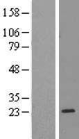 RPL17 Human Over-expression Lysate