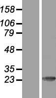 CSEN (KCNIP3) Human Over-expression Lysate