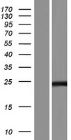 SAPCD1 Human Over-expression Lysate