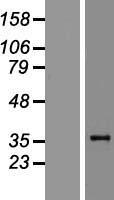 Zhangfei (CREBZF) Human Over-expression Lysate