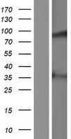 MAP9 Human Over-expression Lysate