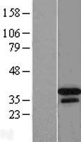DNAJB2 Human Over-expression Lysate
