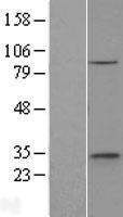 ethanolamine kinase (ETNK1) Human Over-expression Lysate