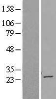 TBC1D28 Human Over-expression Lysate