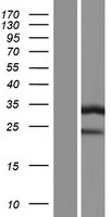 ATP6V1E1 Human Over-expression Lysate