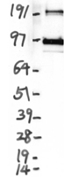 DPP6 Human Over-expression Lysate