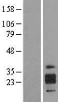 ICAM4 Human Over-expression Lysate