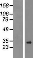 RSPO1 Human Over-expression Lysate