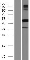 NARF Human Over-expression Lysate