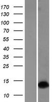 DLX1 Human Over-expression Lysate