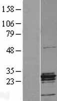 ERAB (HSD17B10) Human Over-expression Lysate
