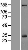 Nucleophosmin (NPM1) Human Over-expression Lysate
