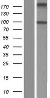 ALDH1L2 Human Over-expression Lysate