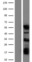 Staufen (STAU1) Human Over-expression Lysate
