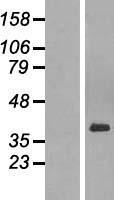 PAR6 (PARD6A) Human Over-expression Lysate