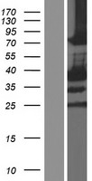 SCML1 Human Over-expression Lysate