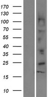 DEFB112 Human Over-expression Lysate