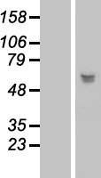 LRRC17 Human Over-expression Lysate