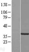 C2orf60 (TYW5) Human Over-expression Lysate
