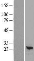 ARL16 Human Over-expression Lysate