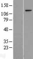 CA150 (TCERG1) Human Over-expression Lysate