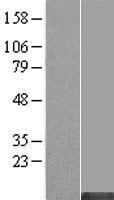 MT1HL1 Human Over-expression Lysate