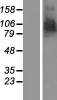ARTS1 (ERAP1) Human Over-expression Lysate
