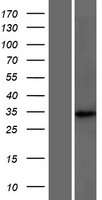 DCUN1D4 Human Over-expression Lysate