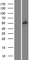 Estrogen Receptor beta (ESR2) Human Over-expression Lysate
