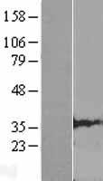 CLDND1 Human Over-expression Lysate