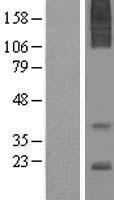 AGTRAP Human Over-expression Lysate