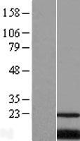 SLC66A1 Human Over-expression Lysate
