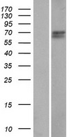 CCDC61 Human Over-expression Lysate