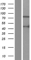 ARHGAP9 Human Over-expression Lysate