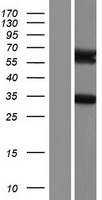 ARHGAP9 Human Over-expression Lysate