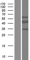 CT47A1 Human Over-expression Lysate