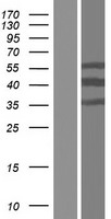 CT47A2 Human Over-expression Lysate