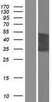 CT47A5 Human Over-expression Lysate