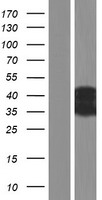 CT47A6 Human Over-expression Lysate
