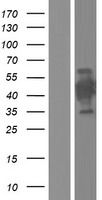 CT47A9 Human Over-expression Lysate