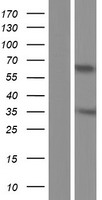 CT47A10 Human Over-expression Lysate